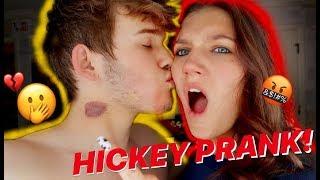 HICKEY PRANK on my GIRLFRIEND!